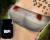 Damage Bandage Top 2