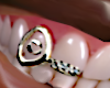 Incisor Grilz
