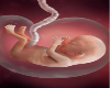 fetus 1-3 weeks
