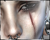 Scar face left