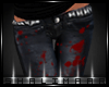 † Bloody pants