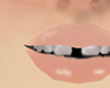 distem teeth