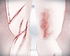 Scratched Arms