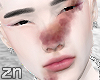 ✩ bruised 2T