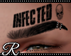 [R] INFECTED