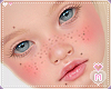 Kid Blush Freckles Moles