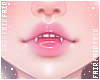 🌸 ADD+ Lips 170