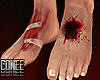 C♥ Feet Blood M