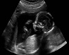 Office Ultrasound