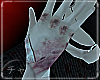 チャ| Bruised Hand