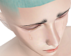 Albinos Head