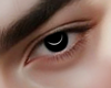 Black eyes