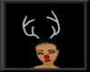 [xo]rudolph nose&antlers