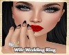 ZY: Wife Wedding Ring