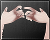 JEV: Hands bruises
