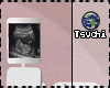 地|triplets Ultrasound