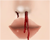 nose blood