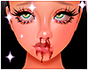 Blood nose