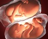 Twin Babies Inside Tummy