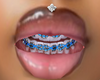 berry braces