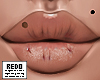 chapped lips; nude