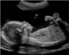 ultrasound frame