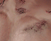 KISS HICKEY