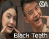 Black Teeth.