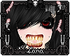 how my teeth look ..