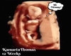 Custom HH Ultrasound Pic
