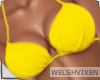 WV: Summer Bikini Top V5