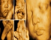 HH Ultrasound Collage