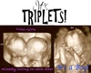 Triplets Custom Pic
