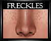 Vera Freckles