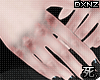 死 After Fight Hands