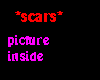 *scars* Pride