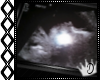[] Ultrasound Photo