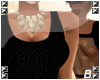 ᙖ| Lace Top - Black