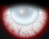 [ML] zombie eye F