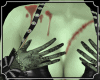Zombie Skin