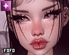 add+ freckles