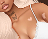Vitiligo 01
