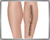 K-Cicatriz na perna