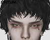 â  Died Black