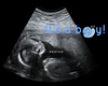 Baby Boy HH Ultrasound