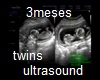 DC/Ultrasound  3 monts