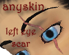 Anyskin Eye Scar