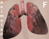inside smog lungs - F