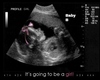 Custom Ultrasound Pic