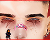 Basal brows